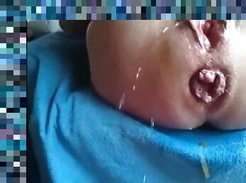 Prolapsed anus grandma masturbating till squirting