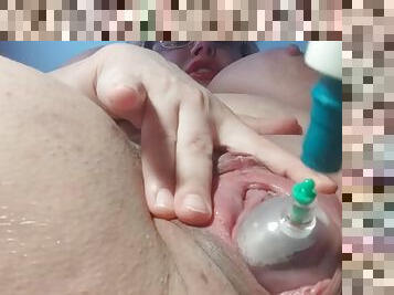 Large cervical pump