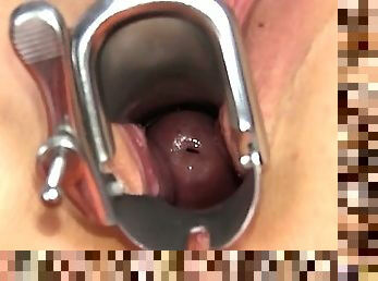 Gyno exam
